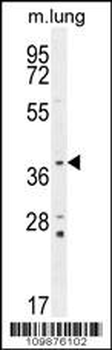 PTK9L Antibody (N-term)
