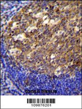 PTK9L Antibody (N-term)