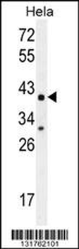 CYC1 Antibody (C-term)