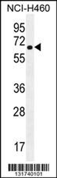 CHRND Antibody (Center)