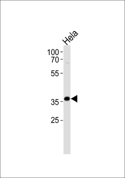 AKR1C3 Antibody (Center)