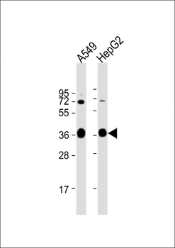 AKR1C3 Antibody (Center)
