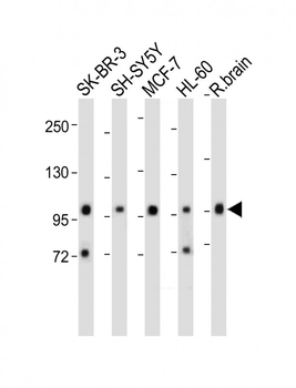 PCDH20 Antibody (Center)
