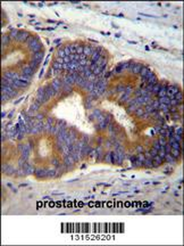 YI016 Antibody (C-term)
