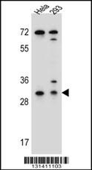 EFNB2 Antibody (Center)