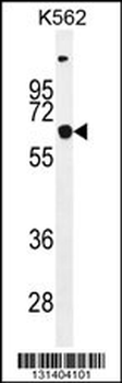SLC16A8 Antibody (C-term)