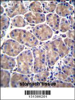 GALNS Antibody (Center)