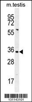 PRSS21 Antibody (Center)