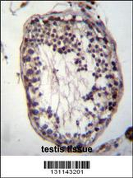 PRSS21 Antibody (Center)