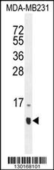 HCFC1R1 Antibody (N-term)