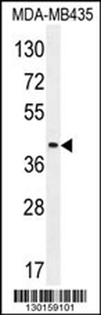 LILRA5 Antibody (N-term)