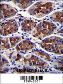 EPHX3 Antibody (C-term)