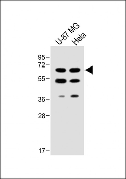 UGT8 antibody (Center)