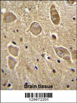 UGT8 antibody (Center)