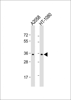 OR7G1 Antibody (N-term)