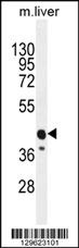 CACNG8 Antibody (N-term)