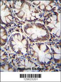 CACNG8 Antibody (N-term)