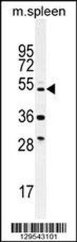 TTC23L Antibody (C-term)