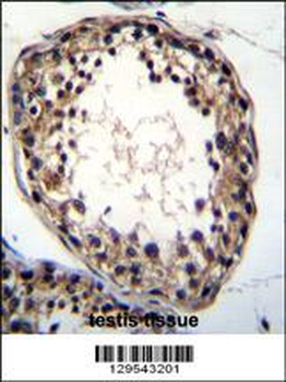 TTC23L Antibody (C-term)