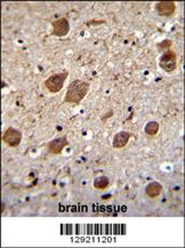 KCTD8 Antibody (C-term)