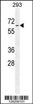 PLD5 Antibody (C-term)