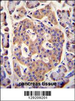 PLD5 Antibody (C-term)