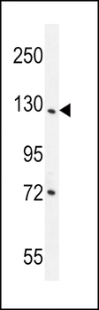 DDX60L Antibody (C-term)