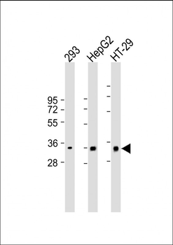 CLEC12B Antibody (C-term)