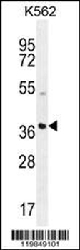 SFRP4 Antibody (C-term)