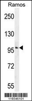 GUCY2D Antibody (Center)