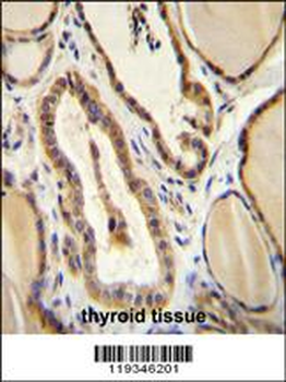GUCY2D Antibody (Center)