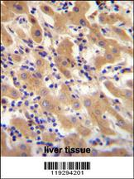 F11 Antibody (Center)
