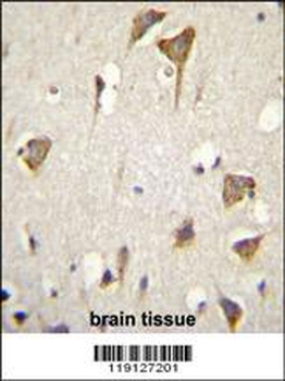 MYO6 Antibody (C-term R1181)