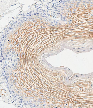 SCEL Antibody (Center)