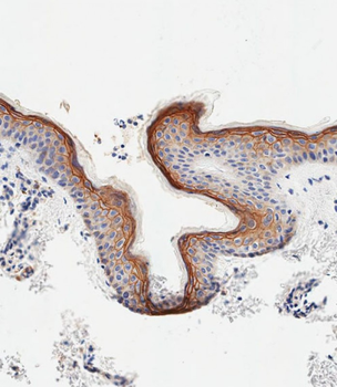 SCEL Antibody (Center)