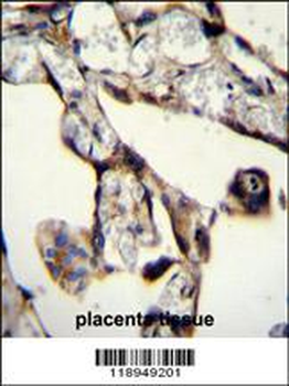 SASH1 Antibody (Center)