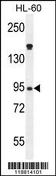 Myeloperoxidase Antibody (N-term)