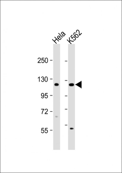 DDX11 Antibody (C-term)