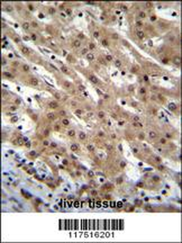 PNN Antibody (Center)