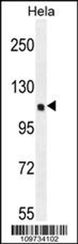 KIAA0999 Antibody (C-term)