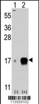 Fagilis (IFITM3) Antibody (Center)