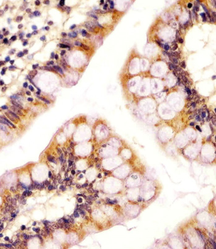 RSBN1 Antibody (N-term)
