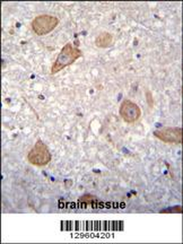 CNIH2 Antibody (N-term)