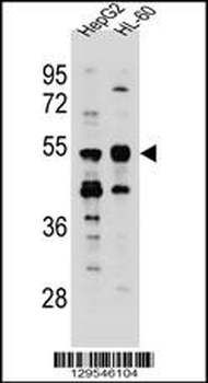 TEKT5 Antibody (Center)