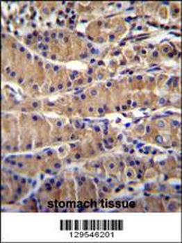 TEKT5 Antibody (Center)