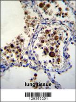 SIGLEC15 Antibody (C-term)