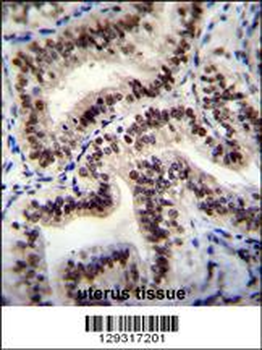HNRNPCL1 Antibody (C-term)