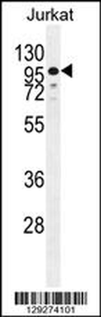 ZNF841 Antibody (N-term)