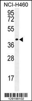 CCDC54 Antibody (Center)