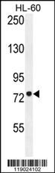 CPT1C Antibody (C-term)